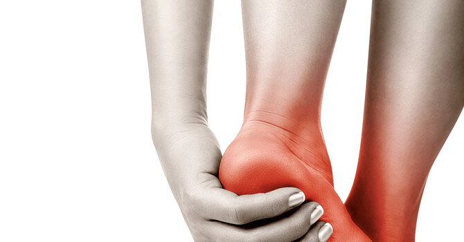 Plantar Fasciitis image
