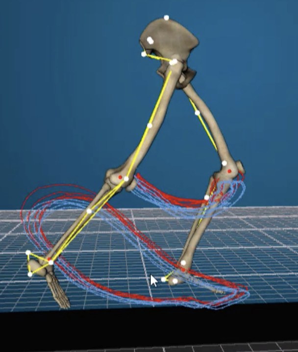 Gait Analysis in Clive, IA | 3D Walking & Running Assessment