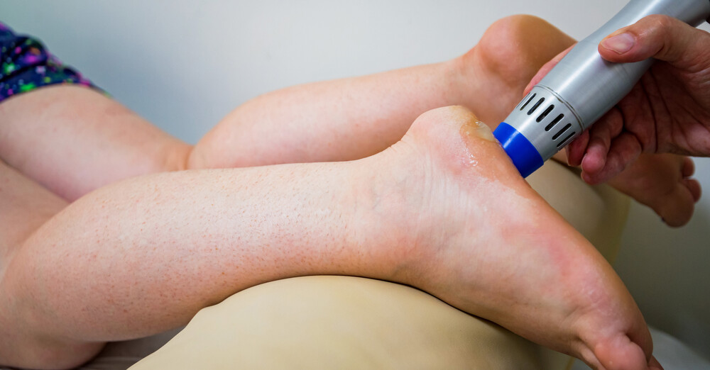 When Shockwave Therapy Makes Sense for Plantar Fasciitis