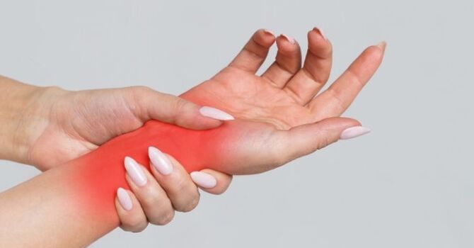 Carpal Tunnel Syndrome