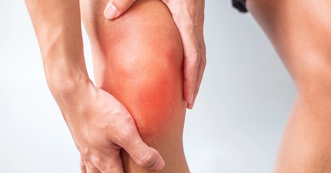 Patellofemoral Pain Syndrome (Runner's Knee)